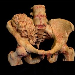 450-dr-goodman_pelvis_0